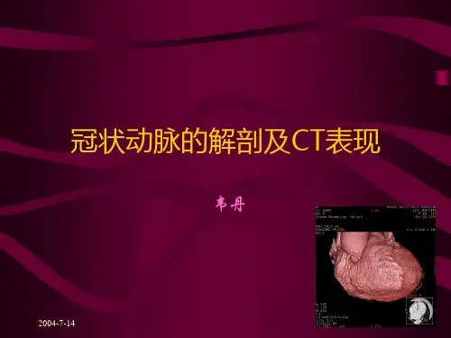 冠状动脉的解剖及C表现PPT课件