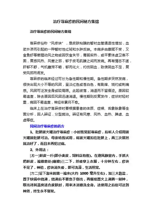 治疗荨麻疹的民间秘方集锦