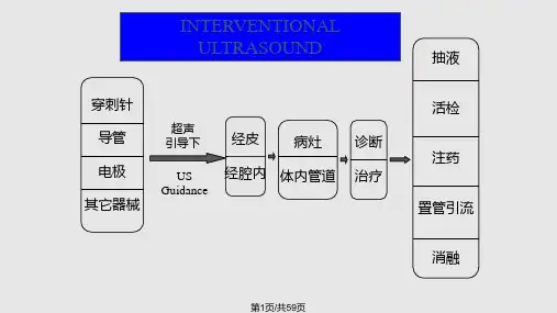 介入性超声周永昌PPT课件