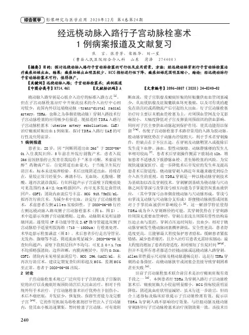经远桡动脉入路行子宫动脉栓塞术1例病案报道及文献复习