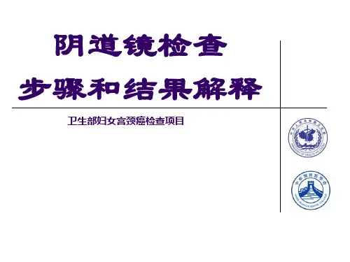 阴道镜检查步骤和结果解释 PPT课件