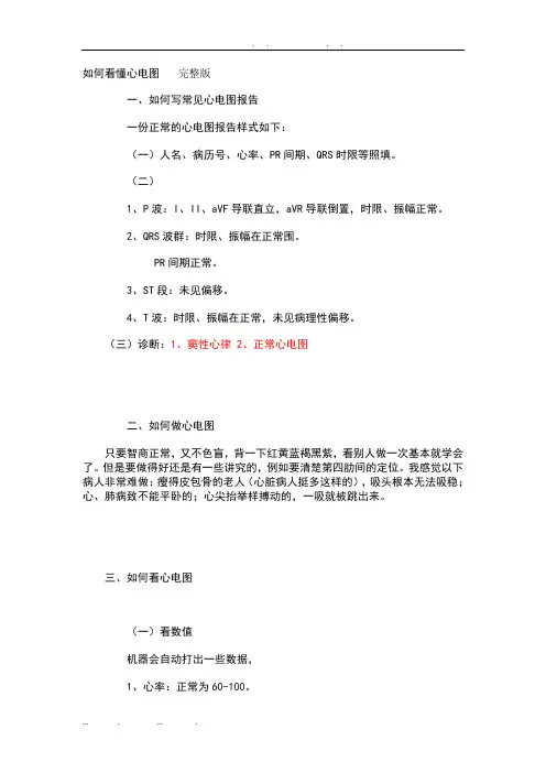 如何看懂心电图完整版