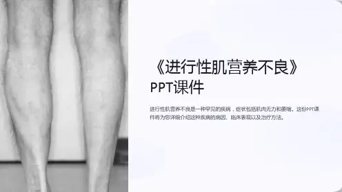 《进行性肌营养不良》课件