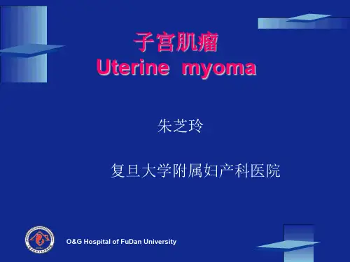 国家级精品课《妇产科学》子宫肌瘤.ppt