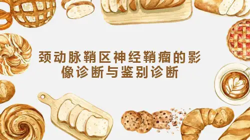 颈动脉鞘区神经鞘瘤的影像诊断与鉴别诊断