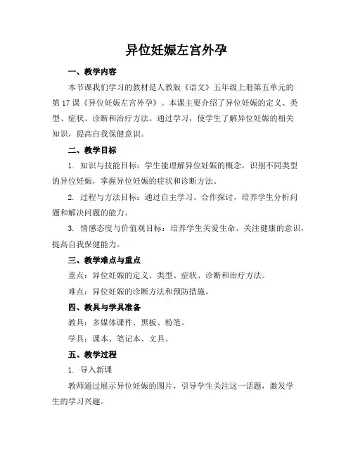异位妊娠左宫外孕