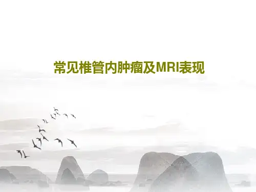 常见椎管内肿瘤及MRI表现32页PPT