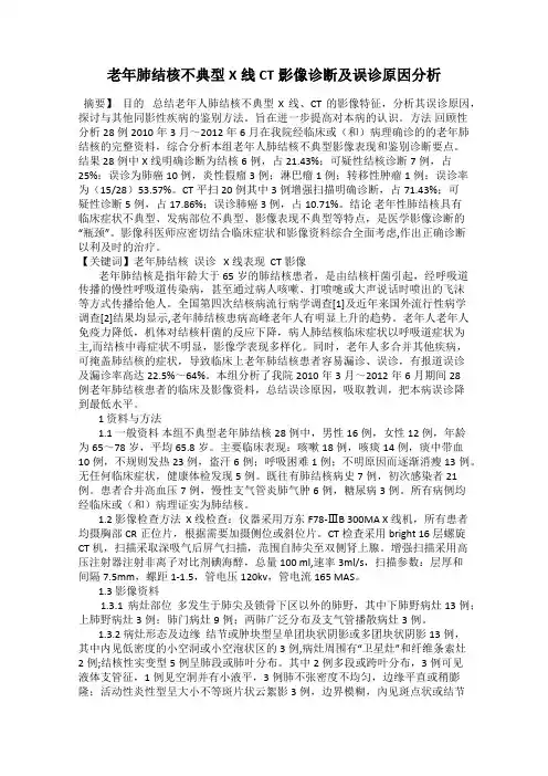 老年肺结核不典型X线CT影像诊断及误诊原因分析
