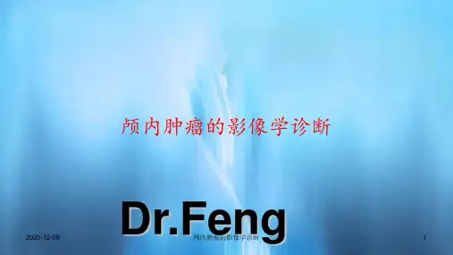 颅内肿瘤的影像学诊断(PPT课件)