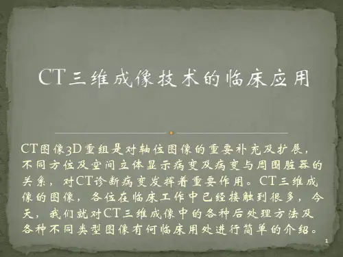 CT三维成像技术的临床应用PPT课件