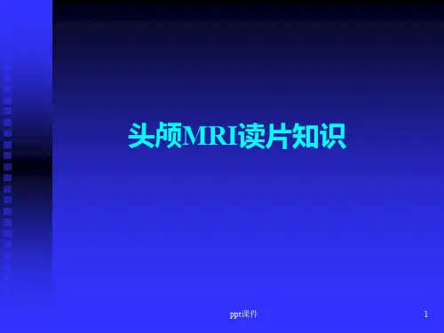 头颅MRI基础知识  ppt课件
