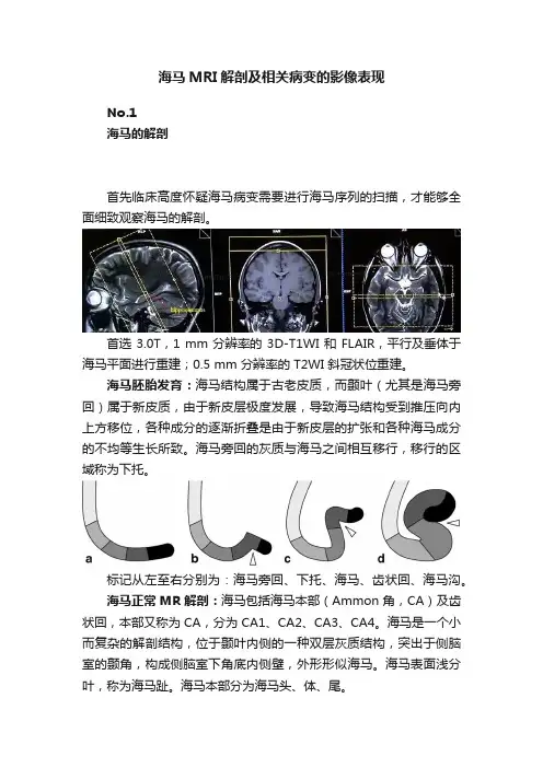 海马MRI解剖及相关病变的影像表现