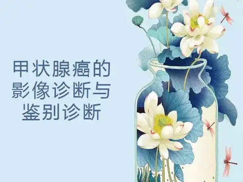 甲状腺癌的影像诊断与鉴别诊断