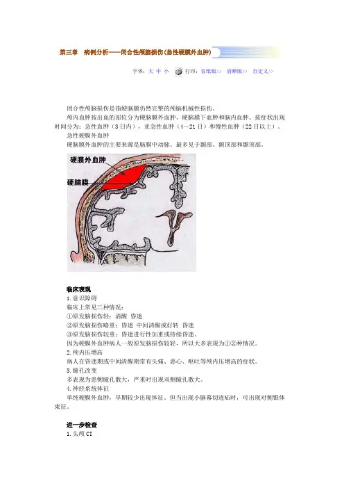 病例分析——闭合性颅脑损伤(急性硬膜外血肿)