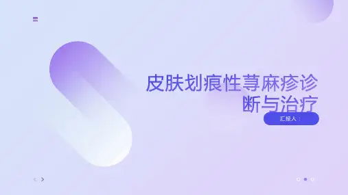 皮肤划痕性荨麻疹诊断与治疗PPT