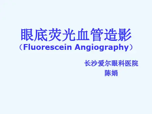 眼底荧光血管造影