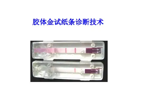 胶体金试纸条检测技术
