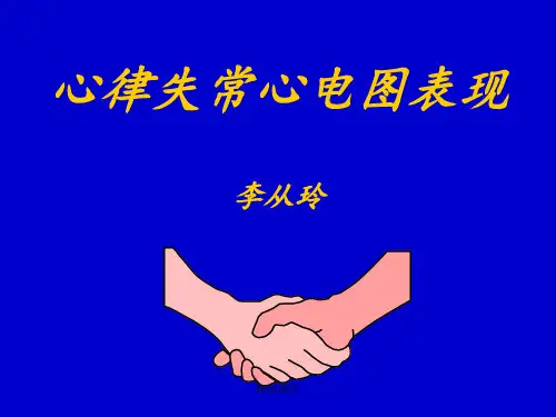 心律失常心电图表现