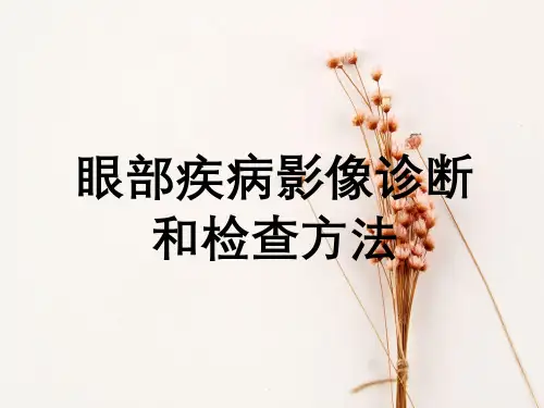 眼部疾病影像诊断与检查方法