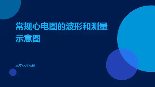 常规心电图的波形和测量示意图
