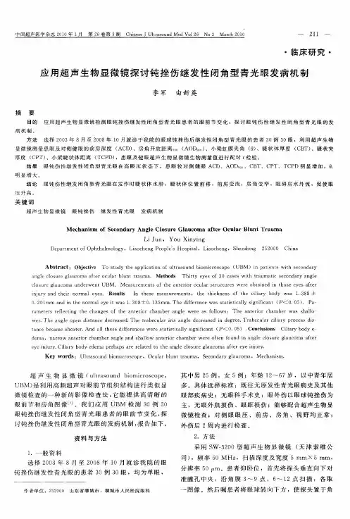 应用超声生物显微镜探讨钝挫伤继发性闭角型青光眼发病机制