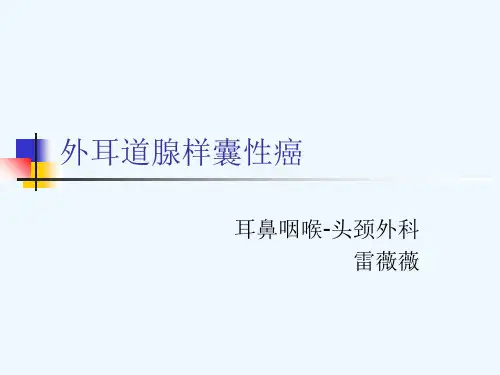 疾病简介外耳道腺样囊性癌概论