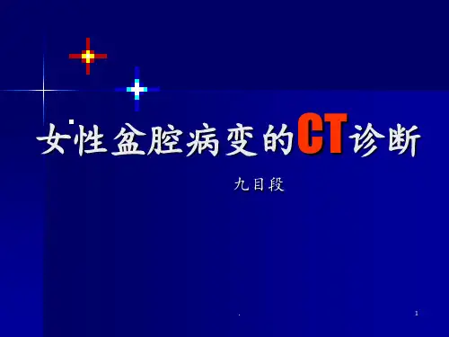 女性盆腔病变的CT诊断(2)PPT课件