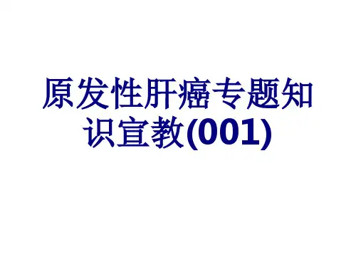 原发性肝癌专题知识宣教PPT优质课件