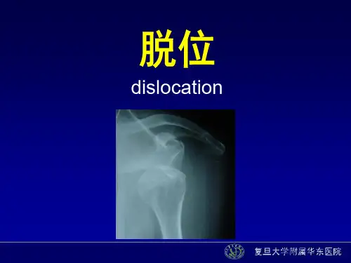 【课件-中医骨伤科学】_脱位
