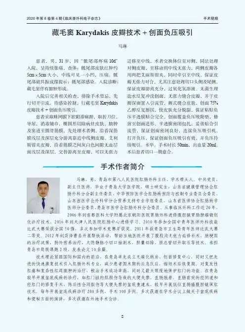 藏毛窦Karydakis皮瓣技术+创面负压吸引