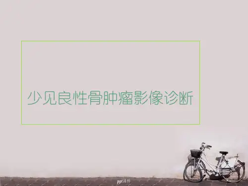 良性骨肿瘤  ppt课件