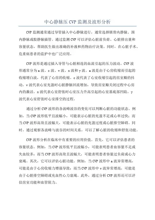 中心静脉压CVP监测及波形分析