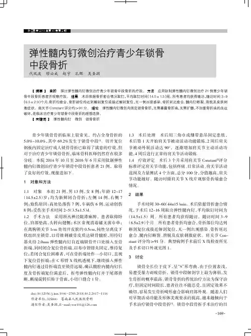 弹性髓内钉微创治疗青少年锁骨中段骨折