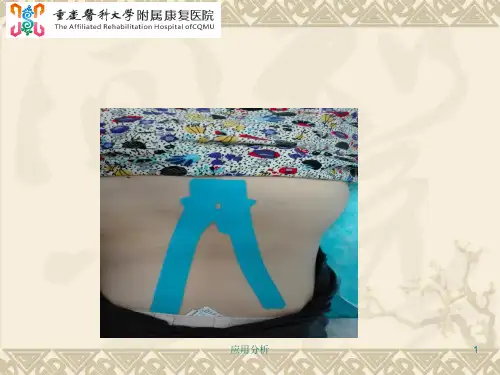 肌内效贴布法医学技术