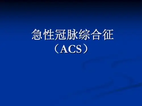 急性冠脉综合征