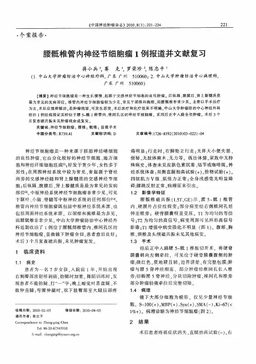 腰骶椎管内神经节细胞瘤1例报道并文献复习