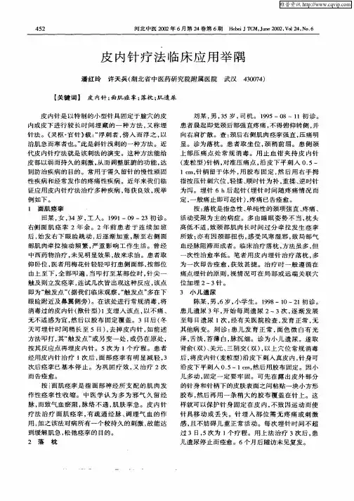 皮内针疗法临床应用举隅