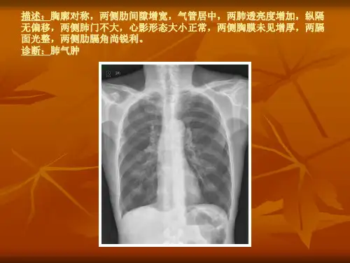 常见X片读片及诊断