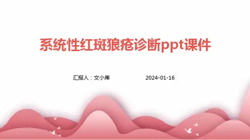 系统性红斑狼疮诊断PPT课件
