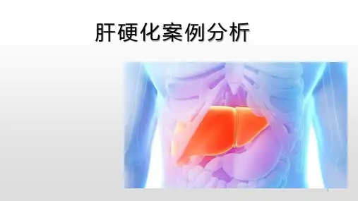 肝硬化案例分析PPT参考课件