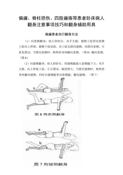 偏瘫、脊柱损伤、四肢瘫痪等患者卧床病人翻身注意事项技巧和翻身辅助用具