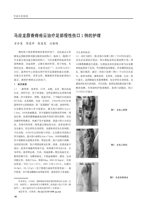 马应龙麝香痔疮膏治疗足部慢性伤口1例的护理