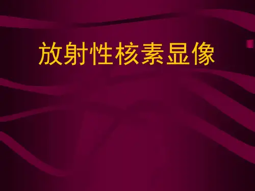 医学影像学：放射性核素显像