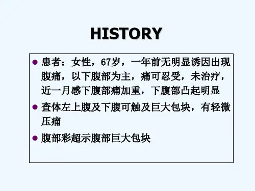 脂肪肉瘤一例CT表现 PPT