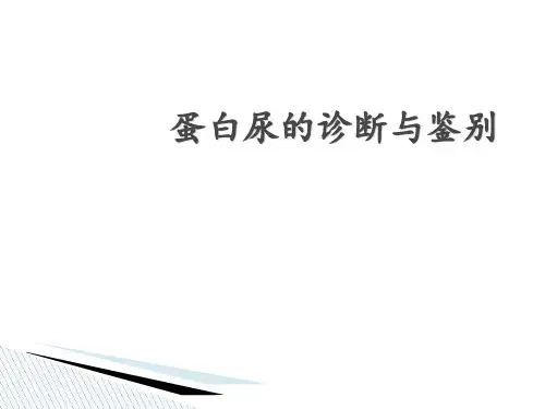 蛋白尿的诊断与鉴别 ppt课件