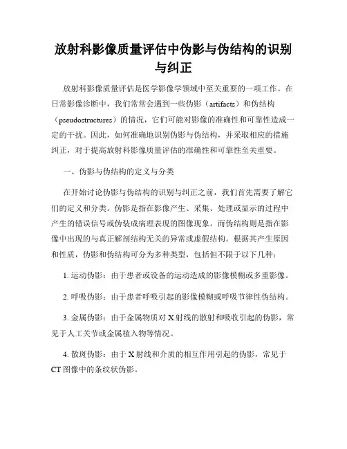放射科影像质量评估中伪影与伪结构的识别与纠正