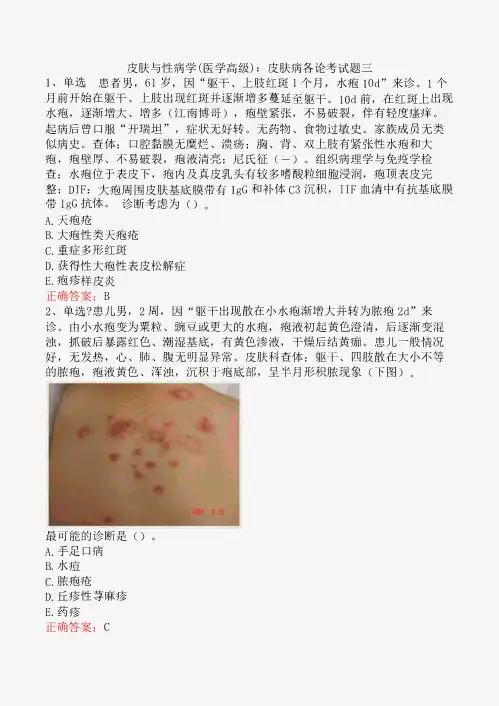 皮肤与性病学(医学高级)：皮肤病各论考试题三