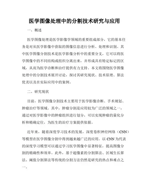 医学图像处理中的分割技术研究与应用