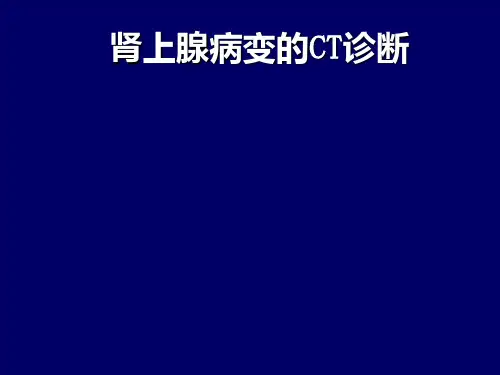 肾上腺病变的CT诊断PPT课件