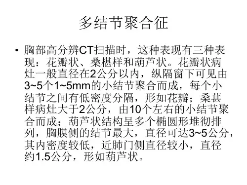 肺部影像学征象 (4)